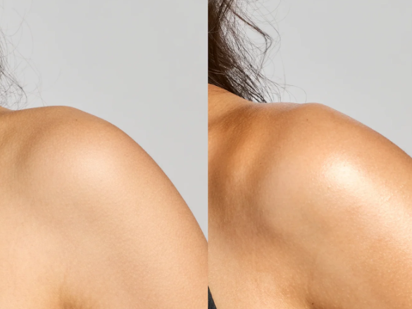 Colorescience Sunforgettable® Total Protection Body Shield Glow