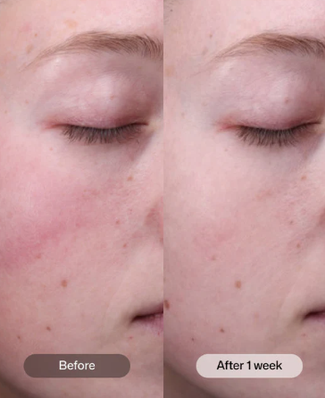 Revision Skincare Radiance + Resurfacing Serum